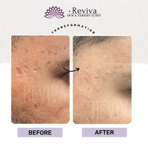 Before and after result 8